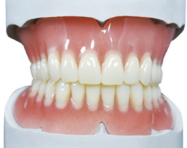 Acrylic denture