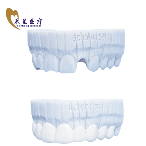 Dental Veneer Factory