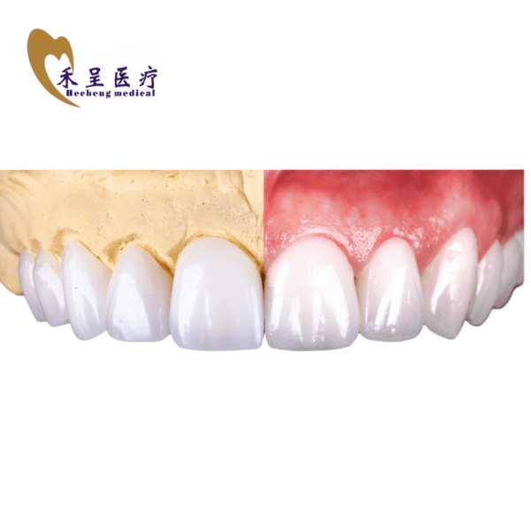 Dental Veneer Manufacturer