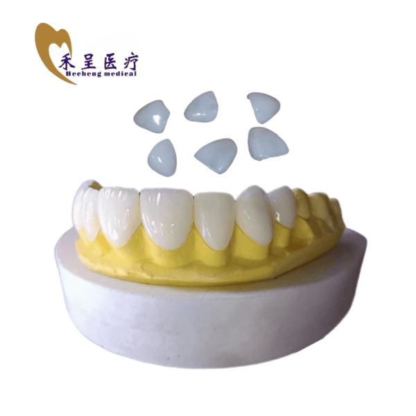 Dental Veneer Teeth