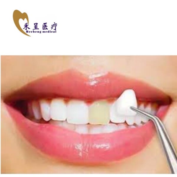 Tooth Veneer Supplier