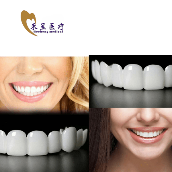 Veneer Teeth Dental