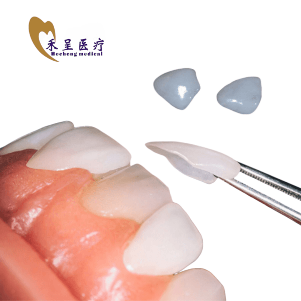 Laminate Veneer Teeth