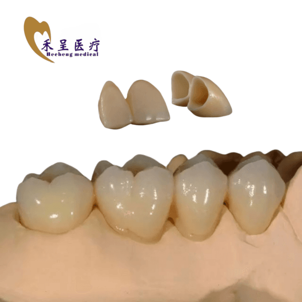 PFM Ceramic Crown