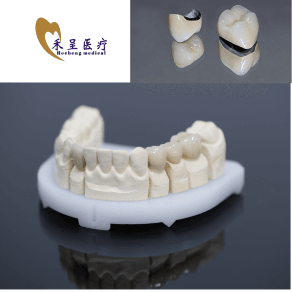 PFM Crown Dental Lab