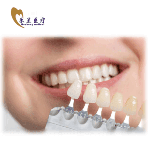 Dental Veneer Hecheng Wholesale