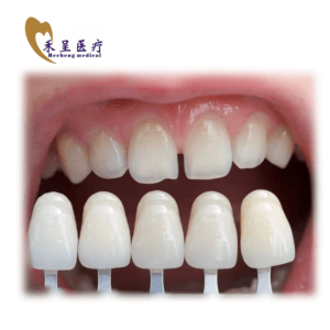 Dental Veneer Teeth Direct Manufacturer