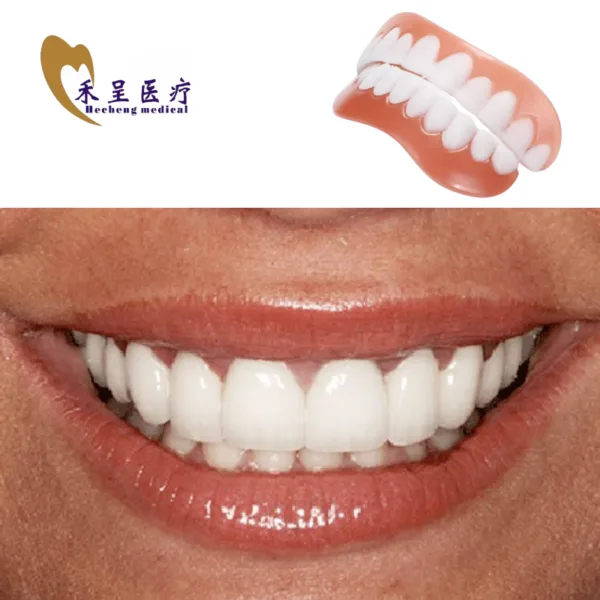 Porcelain Veneer Good Prices