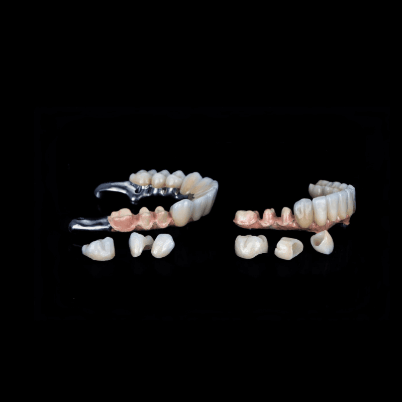 Porcelain Veneers Manufacturer Porcelain Veneers Manufacturer