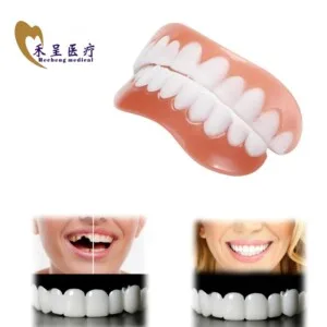 Removable Veneer Teeth Manufacturers